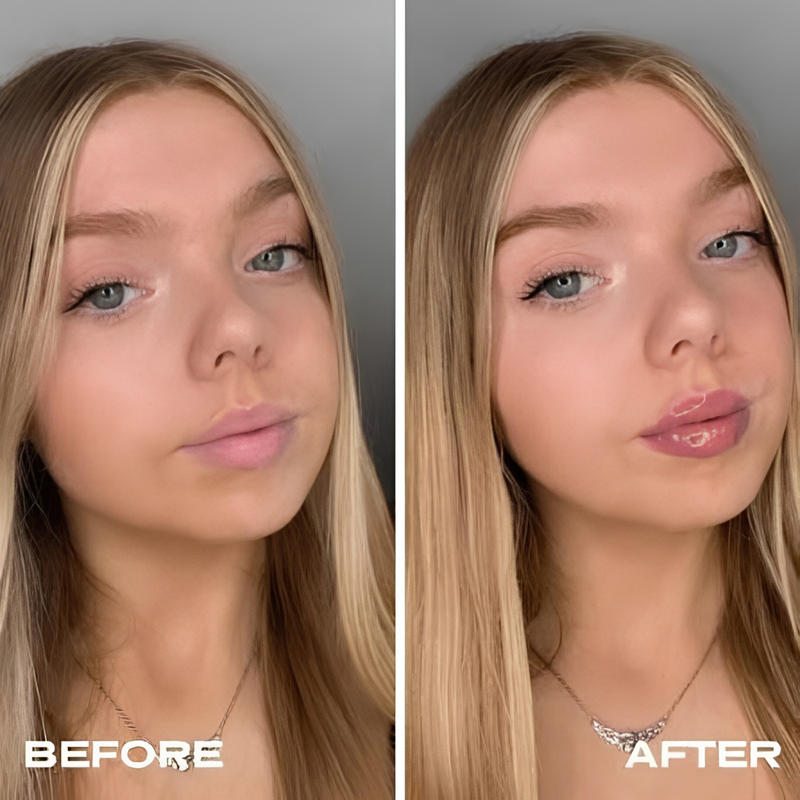 Visible Lip Fullness