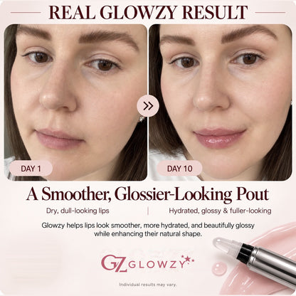 Glowzy Original Lip Plumper™