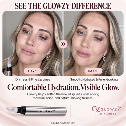 Glowzy Original Lip Plumper™