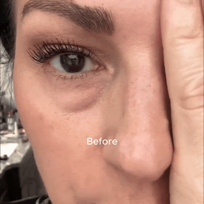 Glowzy Under Eye Brightener™